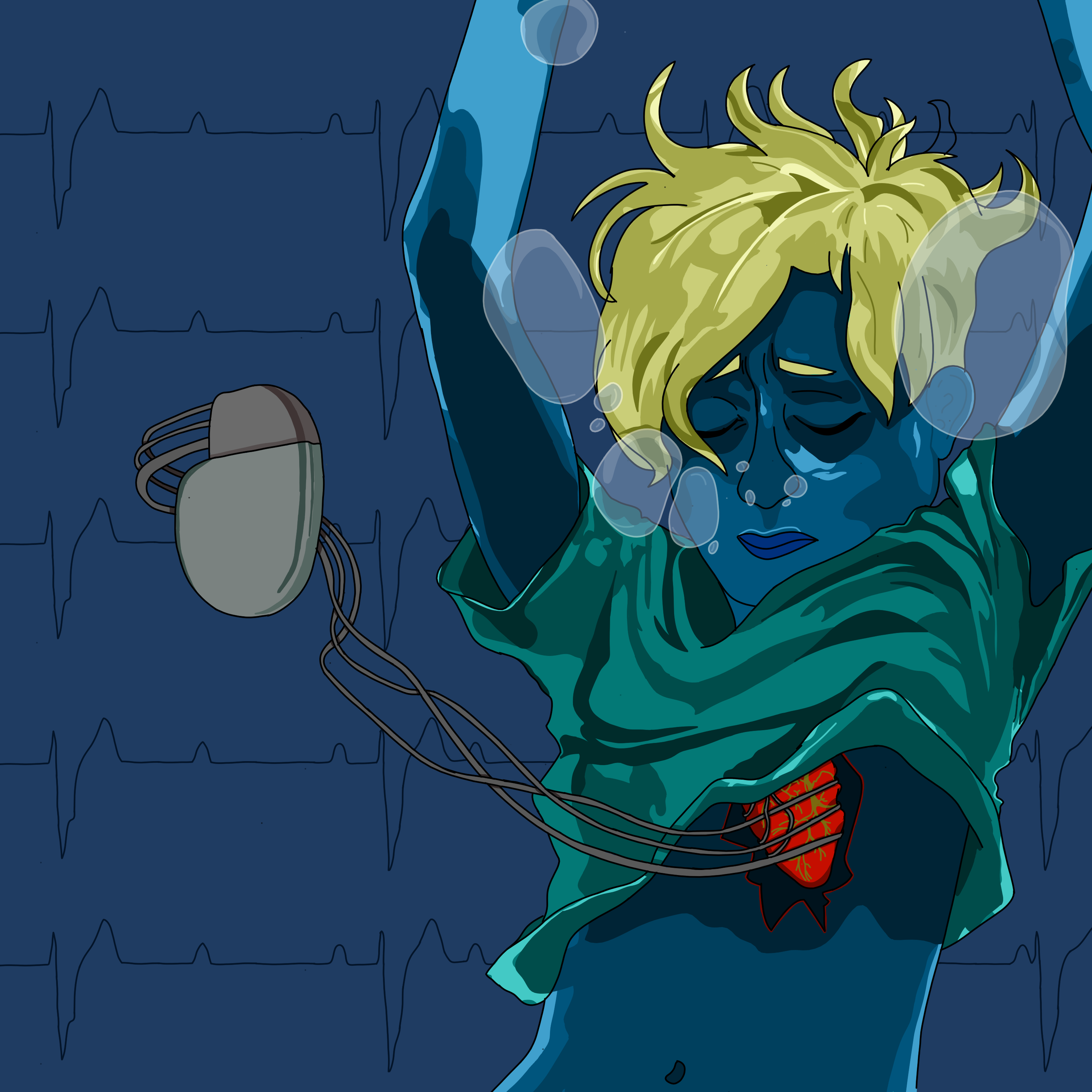 A digital drawing of a person sinking underwater, with a hole in their chest revealing their heart wrapped in wires leading to a pacemaker. In the background are EKG lines indicative of an arrhythmia.